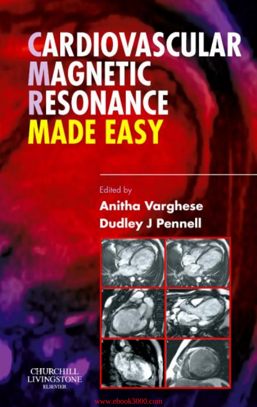 Cardiovascular Magnetic Resonance Made Easy by Unknow