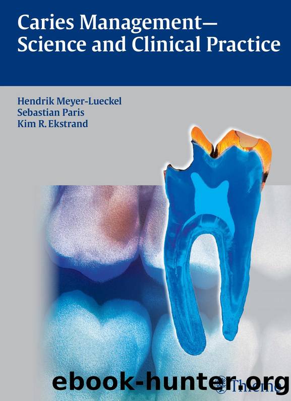 Caries Management Science and Clinical Practice by Unknown