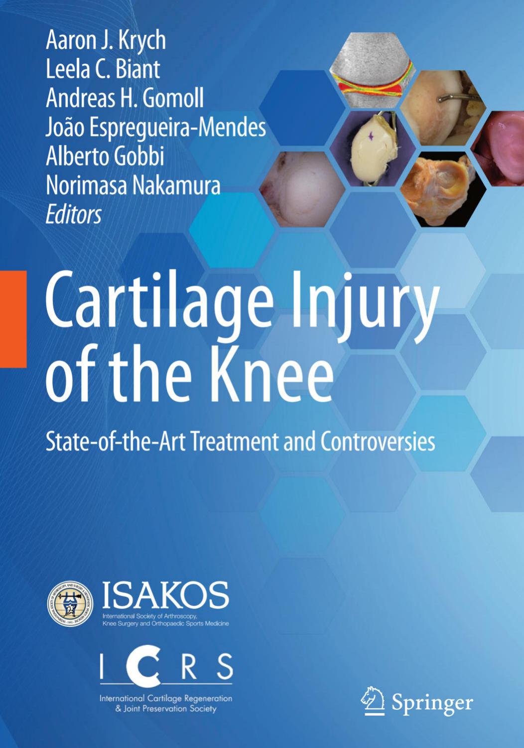 Cartilage Injury of the Knee by Aaron J. Krych Leela C. Biant Andreas H. Gomoll Joao Espregueira