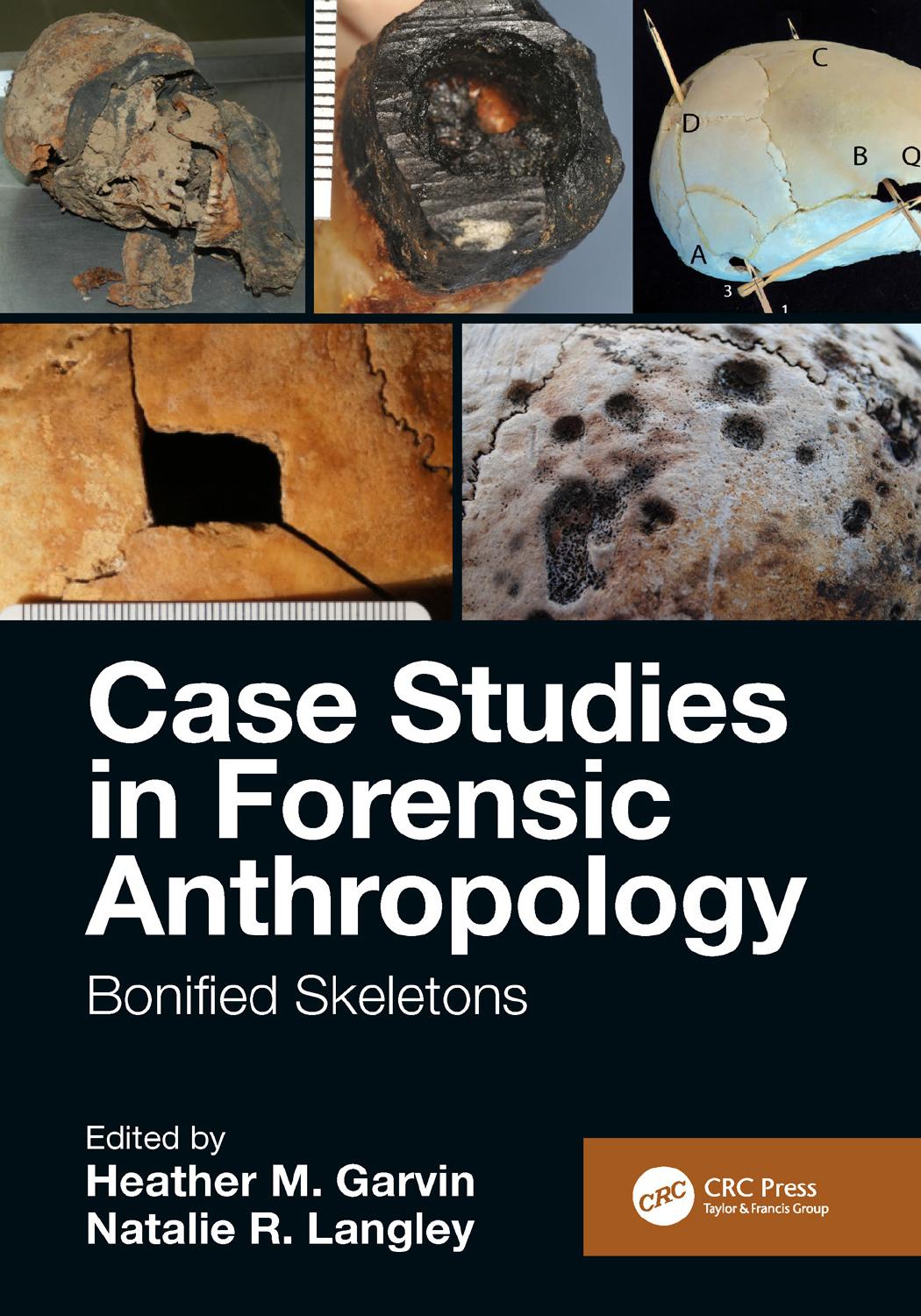 Case Studies in Forensic Anthropology: Bonified Skeletons by Unknow