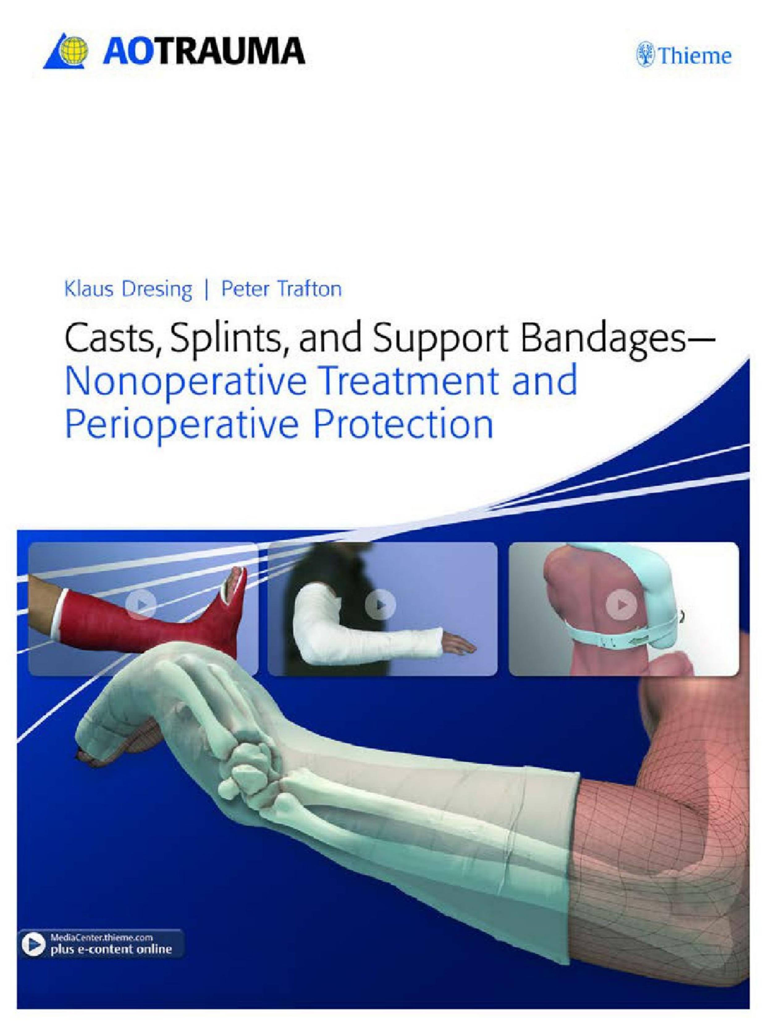 Casts, Splints, and Support Bandages Nonoperative Treatment and Perioperative Protection by Unknown