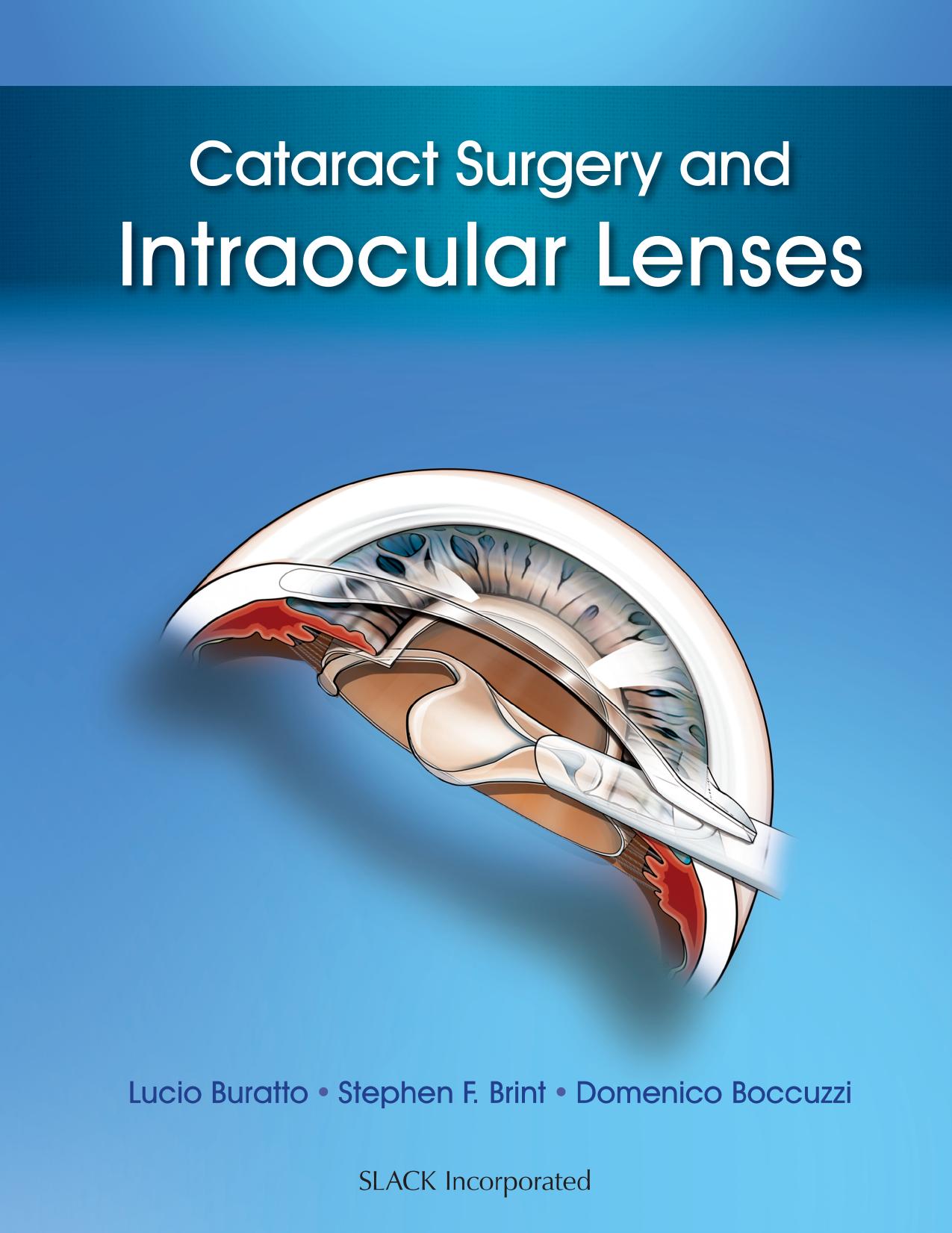 Cataract Surgery and Intraocular Lenses by Unknow