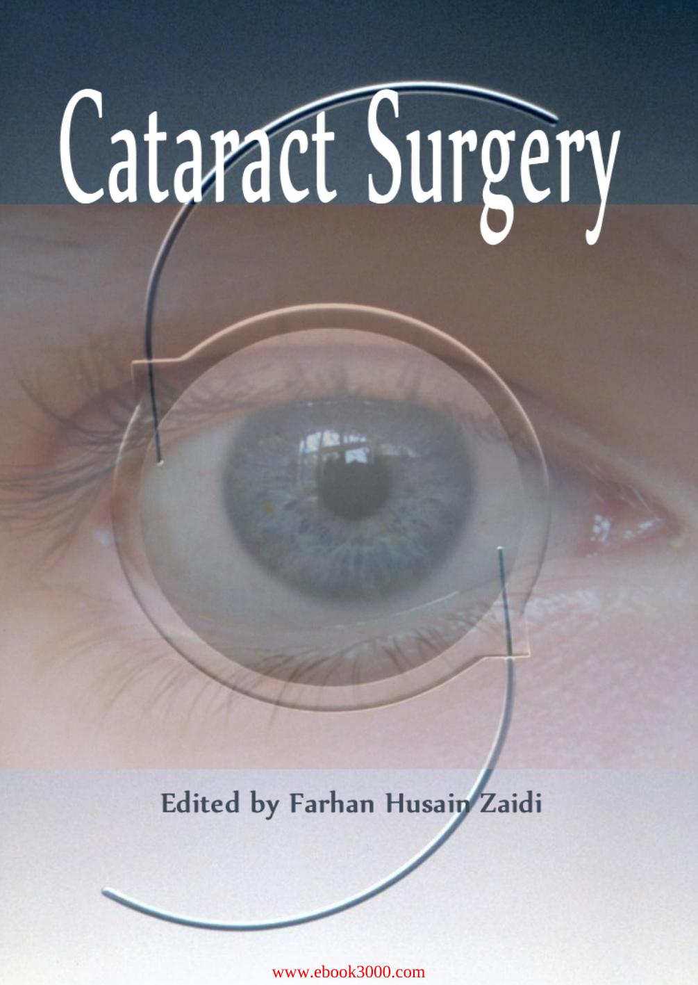 Cataract Surgery ed. by Farhan Husain Zaidi by Unknow