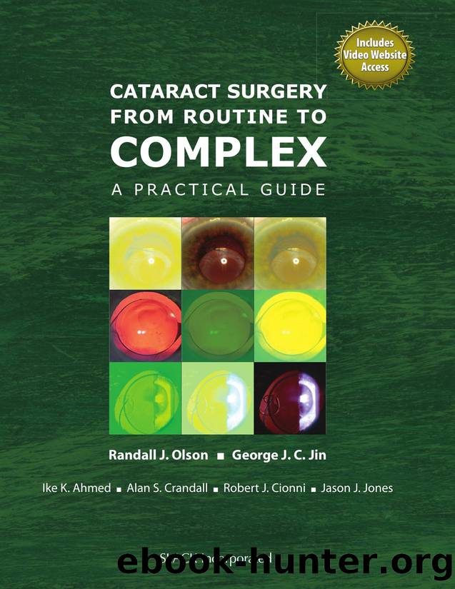Cataract Surgery from Routine to Complex : A Practical Guide by Randall Olson; George Jin; Iqbal Ike Ahmed; Alan Crandall