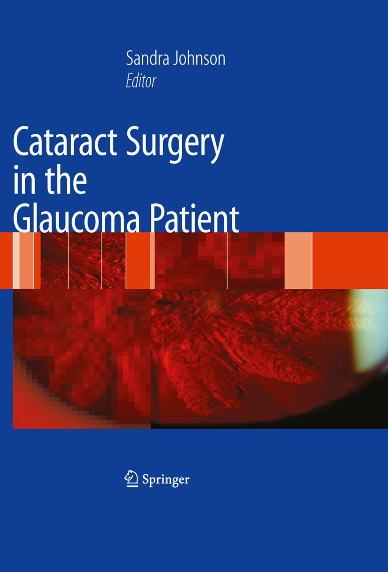 Cataract Surgery in the Glaucoma Patient by Graham A. Lee Ivan Goldberg (auth.) Sandra M. Johnson (eds.)