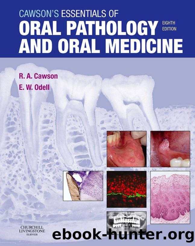 Cawson's Essentials of Oral Pathology and Oral Medicine E-Book by Unknown
