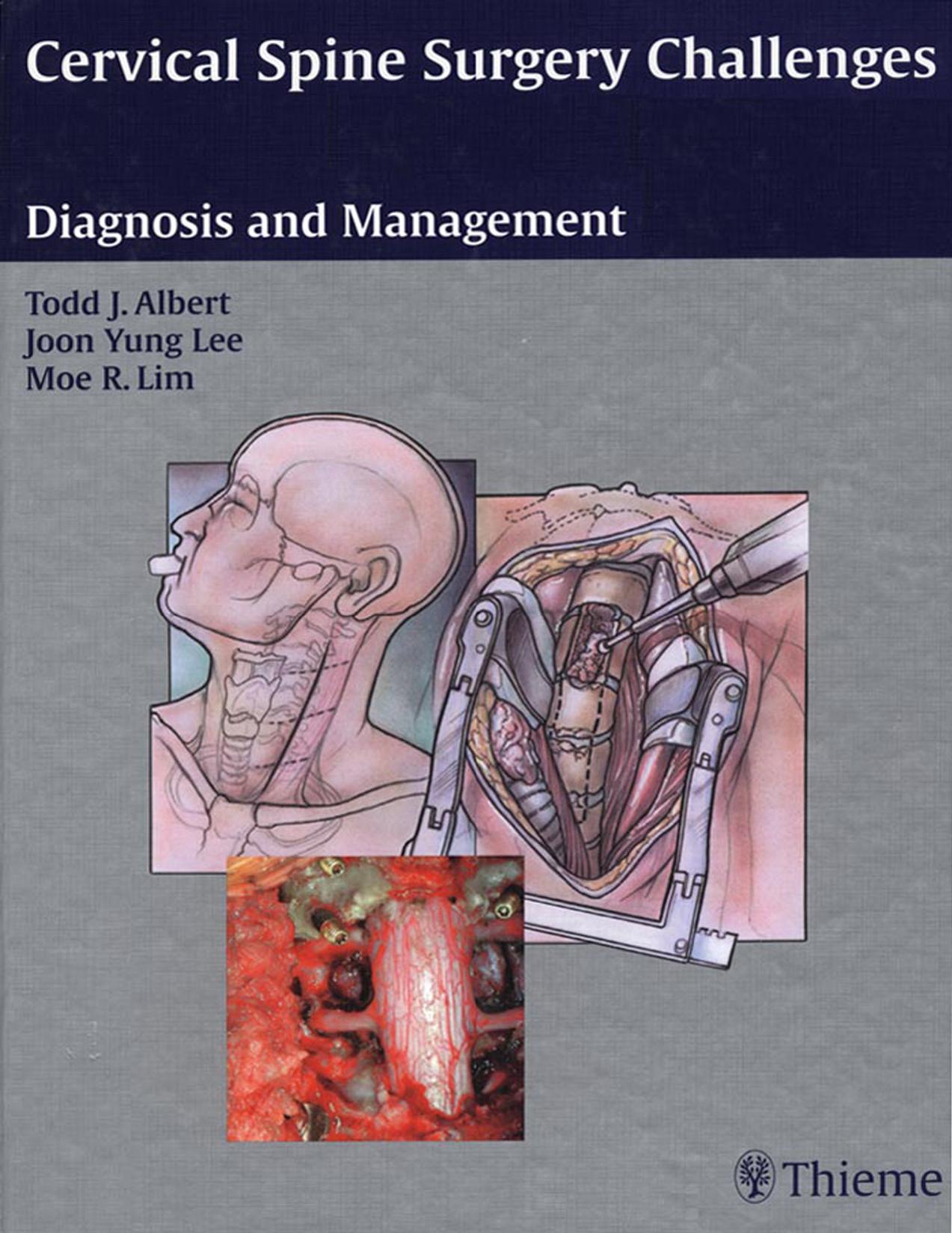 Cervical Spine Surgery Challenges (Repost) by Unknow