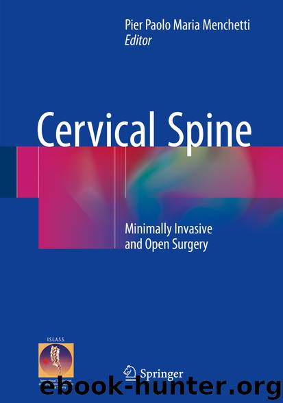 Cervical Spine by Pier Paolo Maria Menchetti