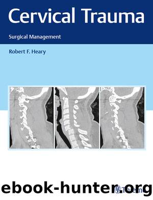 Cervical Trauma by Robert F. Heary;