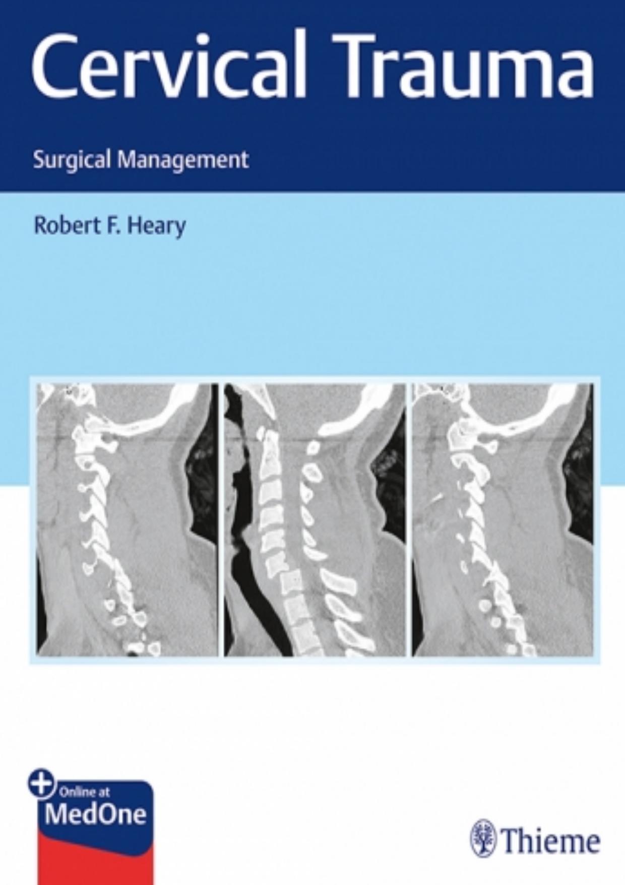 Cervical Trauma: Surgical Management by Unknow