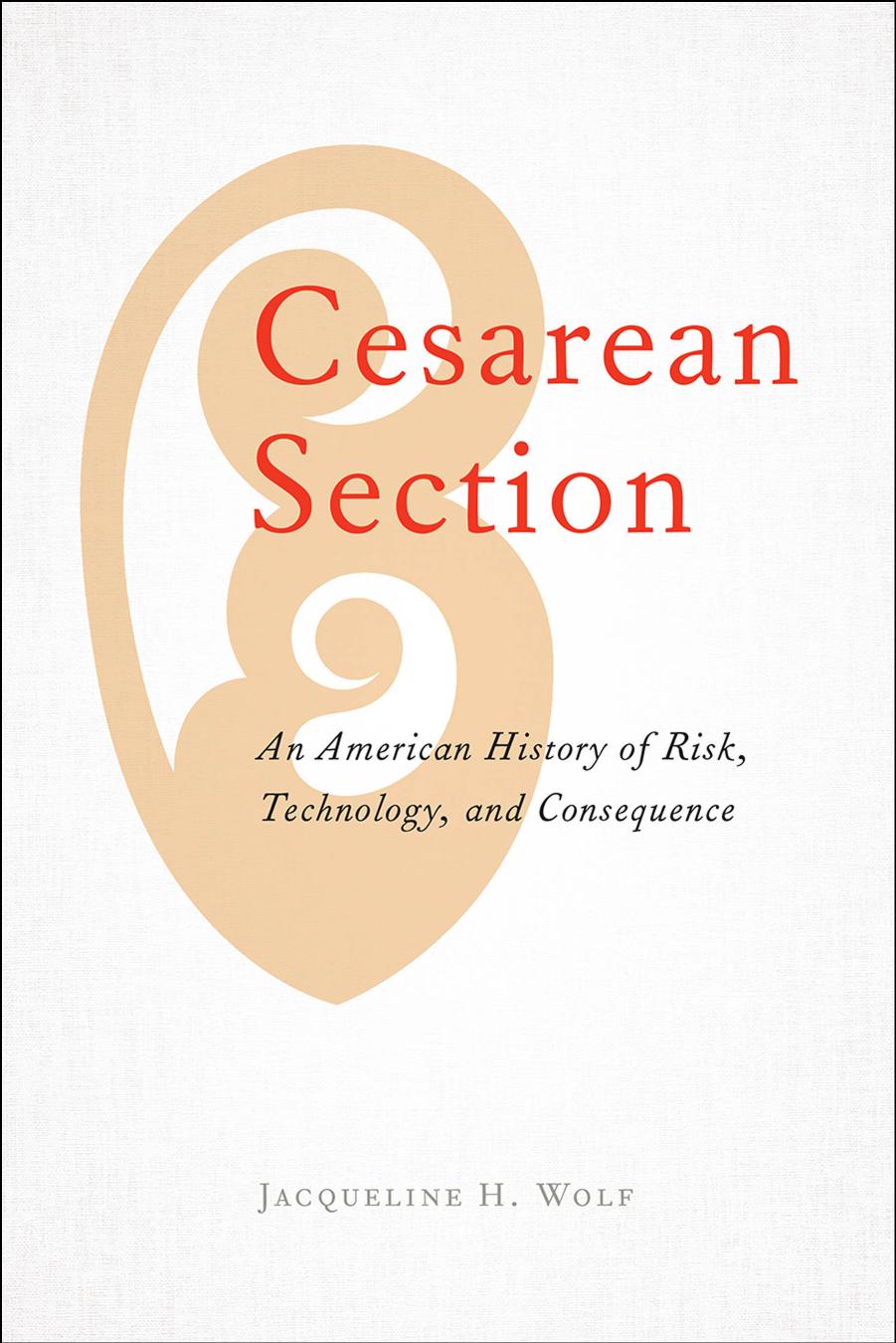 Cesarean Section: An American History of Risk, Technology, and Consequence by Jacqueline H. Wolf