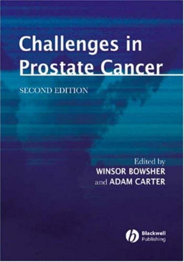 Challenges in Prostate Cancer, 2nd edition by Winsor Bowsher Adam Carter