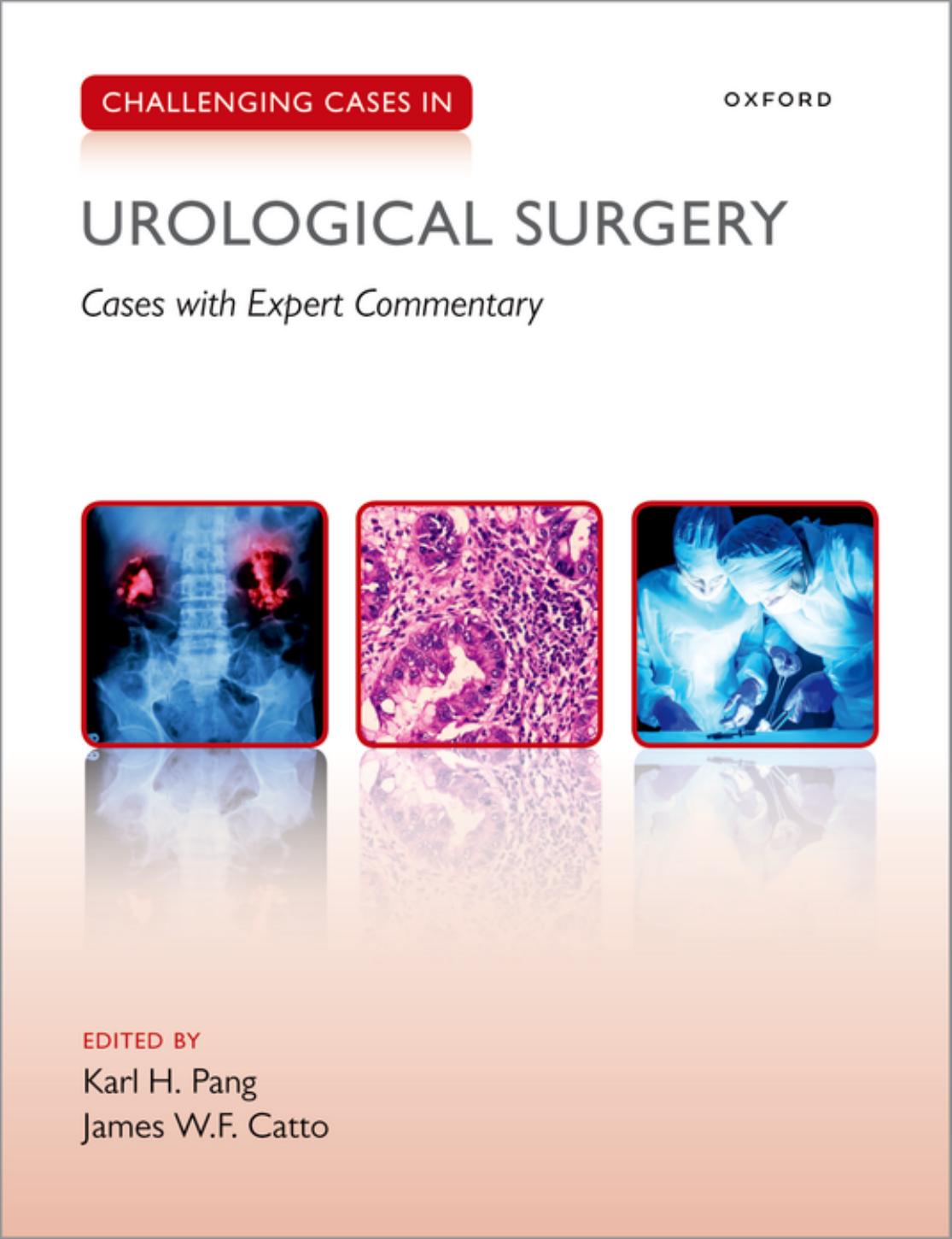 Challenging Cases in Urological Surgery by Karl Pang James Catto