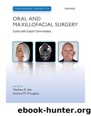 Challenging Concepts in Oral and Maxillofacial Surgery: Cases with Expert Commentary by Unknown