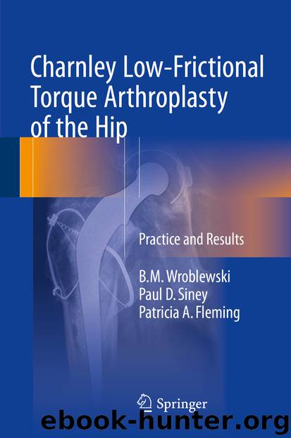 Charnley Low-Frictional Torque Arthroplasty of the Hip by B.M. Wroblewski Paul D. Siney & Patricia A. Fleming