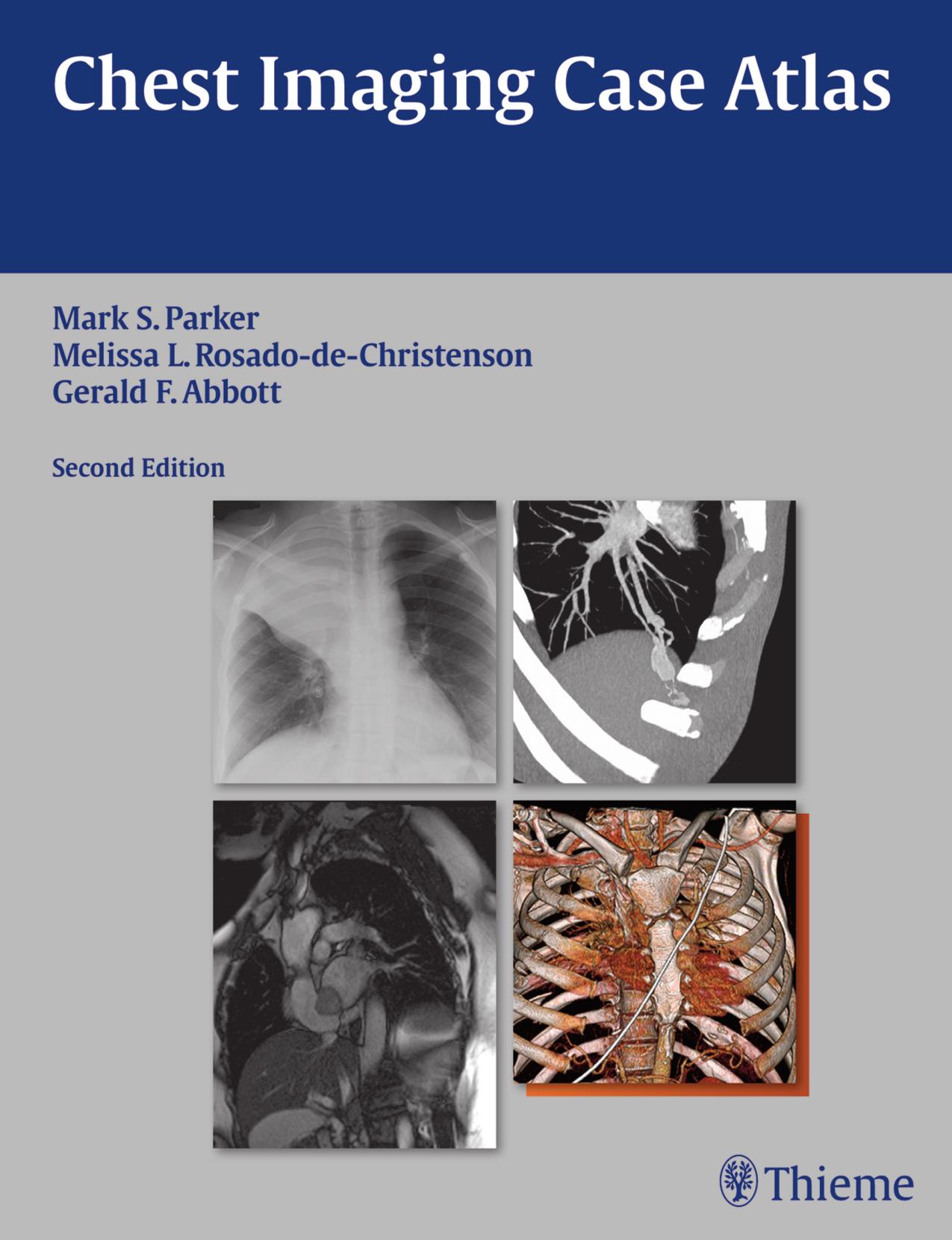 Chest Imaging Case Atlas by Mark S. Parker Melissa L. Rosado-de-Christenson Gerald F. Abbott