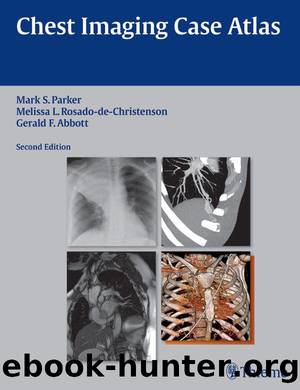 Chest Imaging Case Atlas by Parker Mark S. & Rosado-de-Christenson Melissa L. & Abbott Gerald F