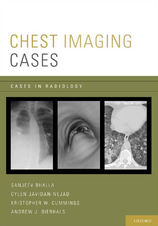 Chest Imaging Cases (Cases in Radiology) by Sanjeev Bhalla