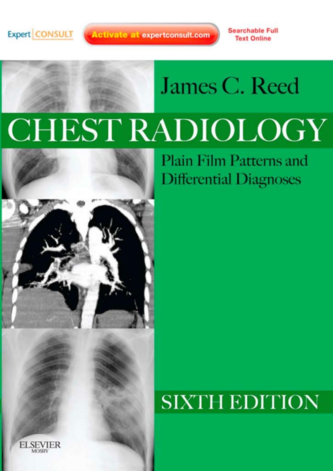 Chest Radiology: Plain Film Patterns and Differential Diagnoses by James C. Reed