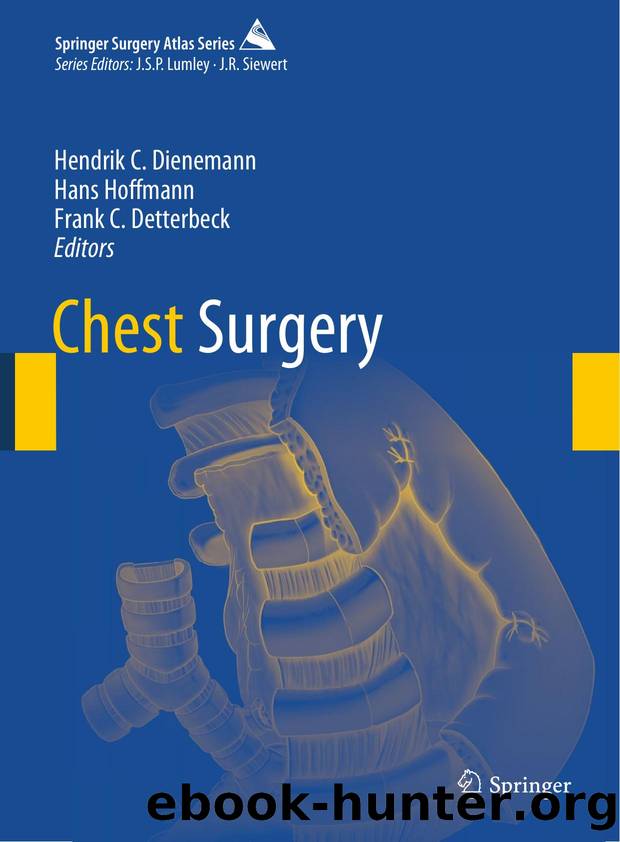 Chest Surgery by Dienemann Hendrik C