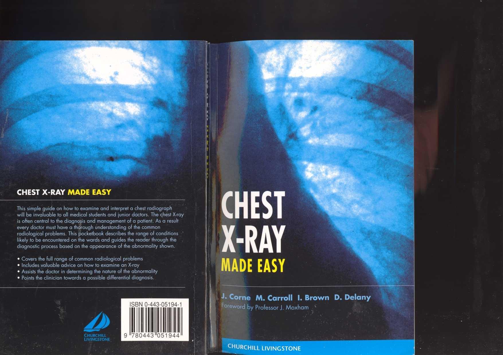 Chest X-Ray Made Easy by Jonathan Corne Mary Carroll David Delany