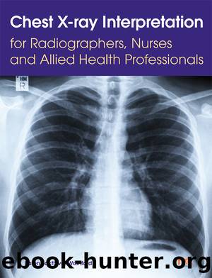 Chest X-ray Interpretation for Radiographers, Nurses and Allied Health Professionals by Sakthivel-Wainford Karen;