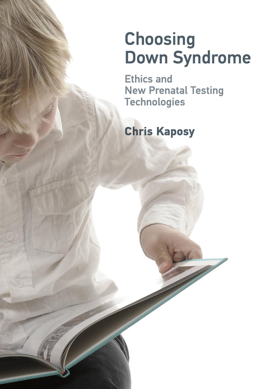 Choosing Down Syndrome by Kaposy Chris
