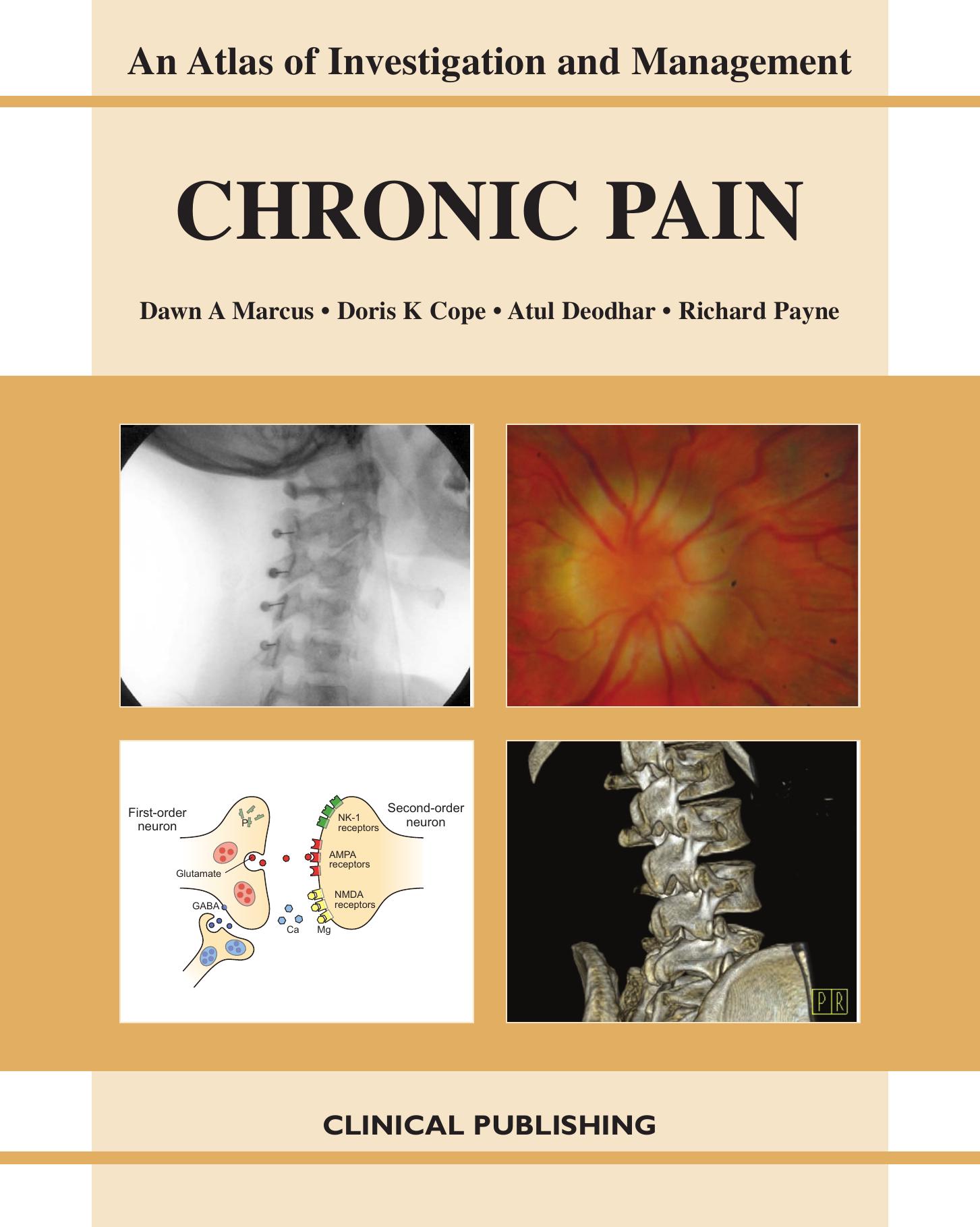 Chronic Pain: Atlas of Investigation and Management by Dawn A. Marcus