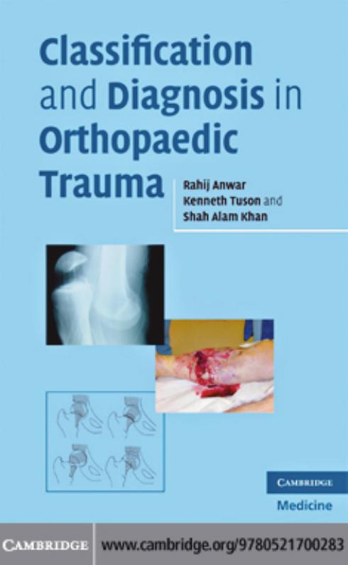 Classification and diagnosis in orthopaedic trauma by Rahij Anwar; Kenneth W R Tuson; Shah Alam Khan F.R.C.S