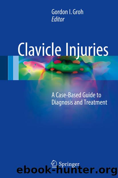 Clavicle Injuries by Gordon I. Groh