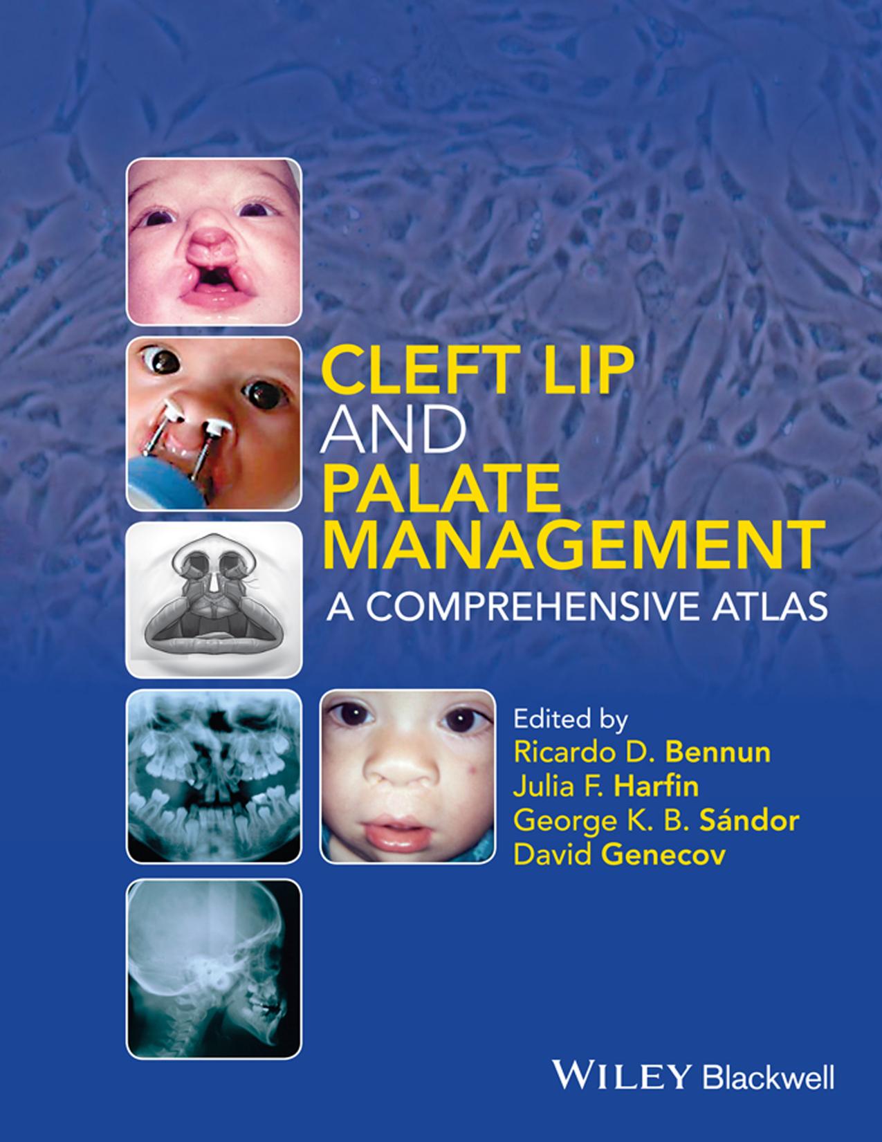 Cleft lip and palate management : a comprehensive atlas by Bennun Ricardo D.; Genecov David; Harfin Julia F. de; Sándor George K. B