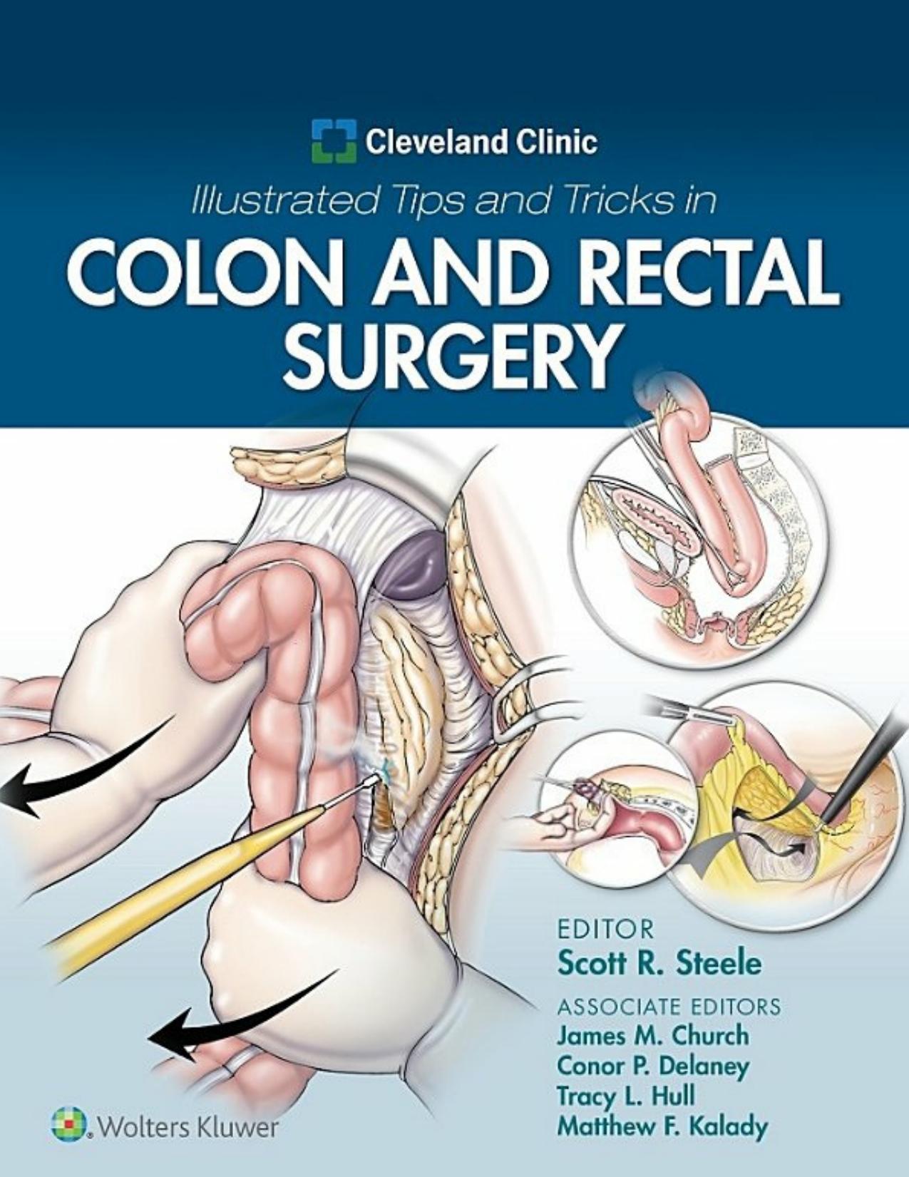 Cleveland Clinic Illustrated Tips and Tricks in Colon and Rectal Surgery by Scott Steele James Church Conor Delaney Tracy Hull Matthew Kalady