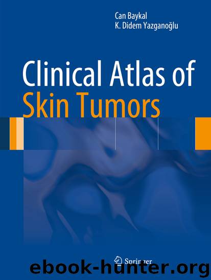 Clinical Atlas of Skin Tumors by Can Baykal & K. Didem Yazganoğlu
