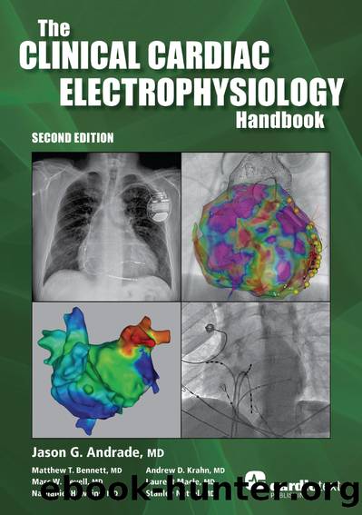 Clinical Cardiac Electrophysiology Handbook, Second Edition by Jason Andrade;