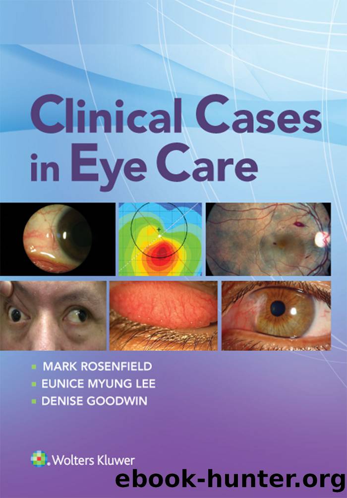 Clinical Cases in Eye Care by Rosenfield Mark;