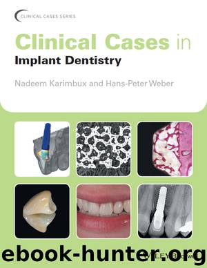 Clinical Cases in Implant Dentistry by Nadeem Karimbux Hans-Peter Weber & Hans-Peter Weber