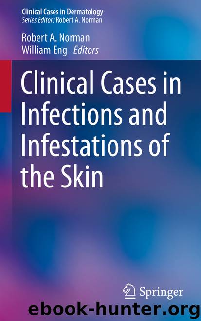 Clinical Cases in Infections and Infestations of the Skin by Robert A. Norman & William Eng