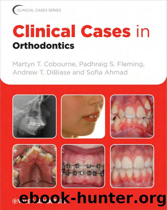 Clinical Cases in Orthodontics by Martyn T. Cobourne Padhraig S. Fleming Andrew T. DiBiase and Sofia Ahmad