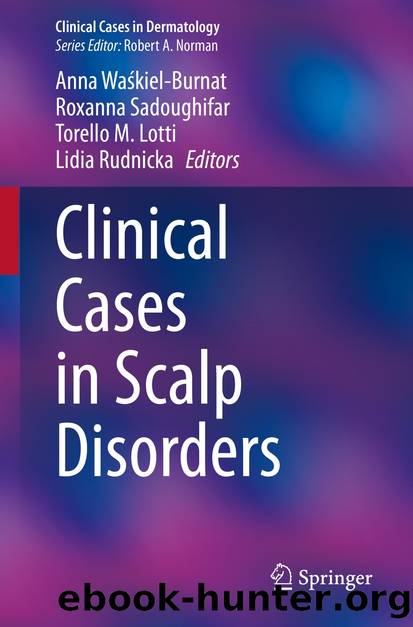 Clinical Cases in Scalp Disorders by Unknown
