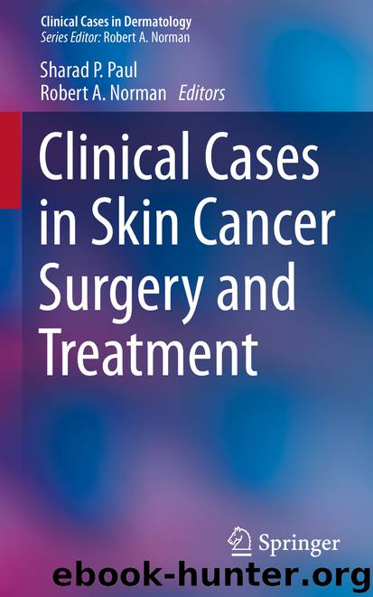 Clinical Cases in Skin Cancer Surgery and Treatment by Sharad P. Paul & Robert A. Norman
