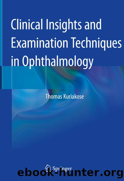 Clinical Insights and Examination Techniques in Ophthalmology by Thomas Kuriakose