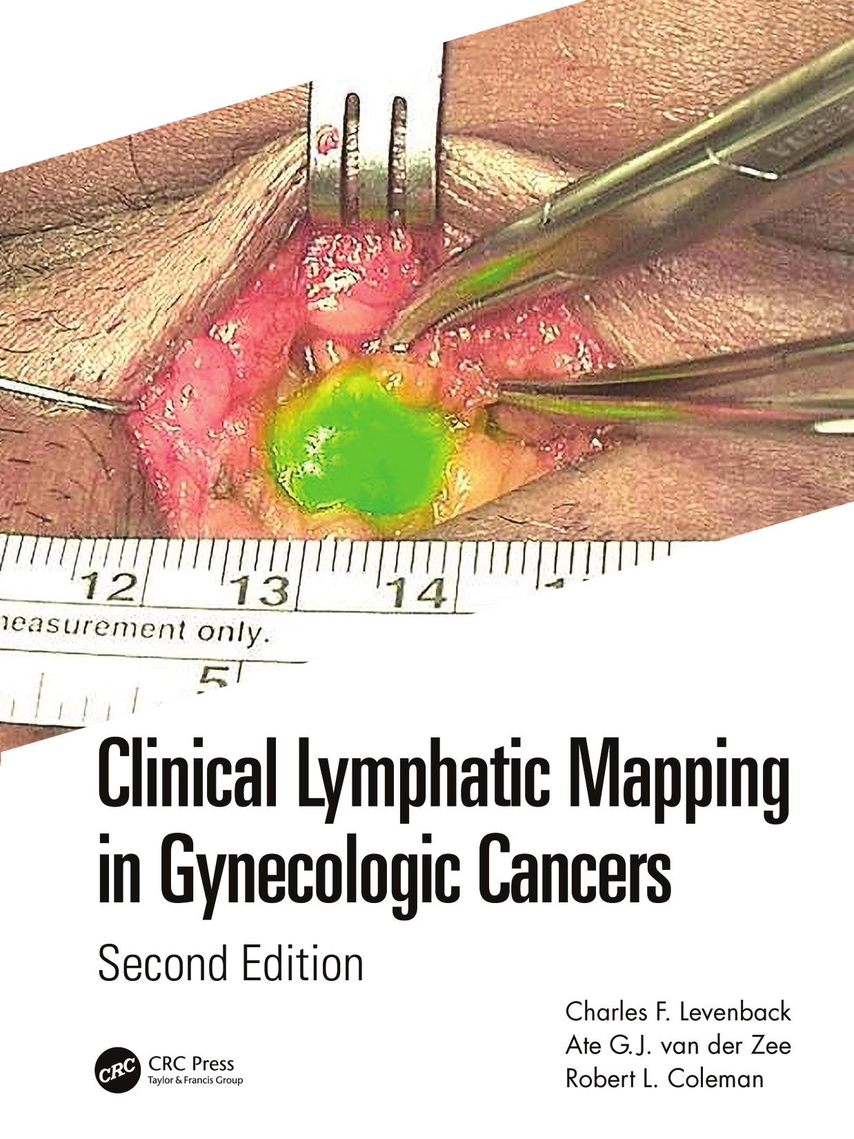 Clinical Lymphatic Mapping in Gynecologic Cancers by Charles Levenback (editor) Ate GJ van der Zee (editor) Robert L. Coleman (editor)