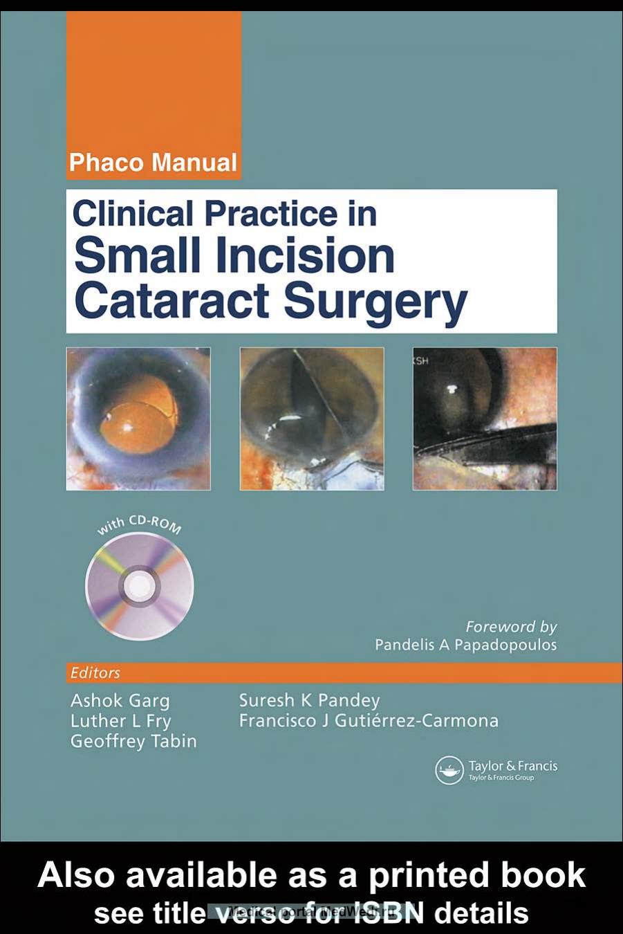 Clinical Practice in Small Incision Cataract Surgery by Garg A. Fry L.L. Tabin G
