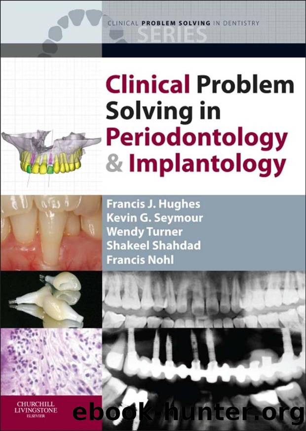 Clinical Problem Solving in Periodontology and Implantology by Unknown