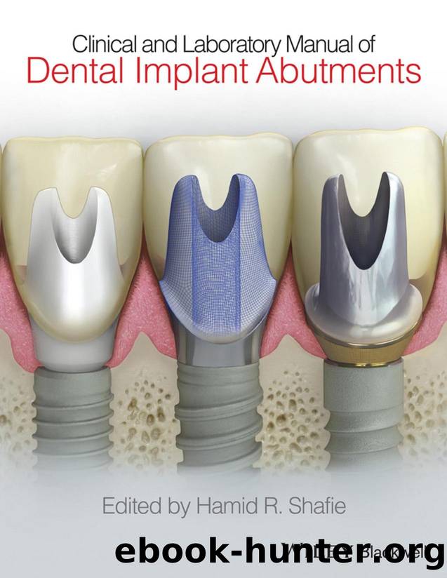 Clinical and Laboratory Manual of Dental Implant Abutments by Shafie Hamid R