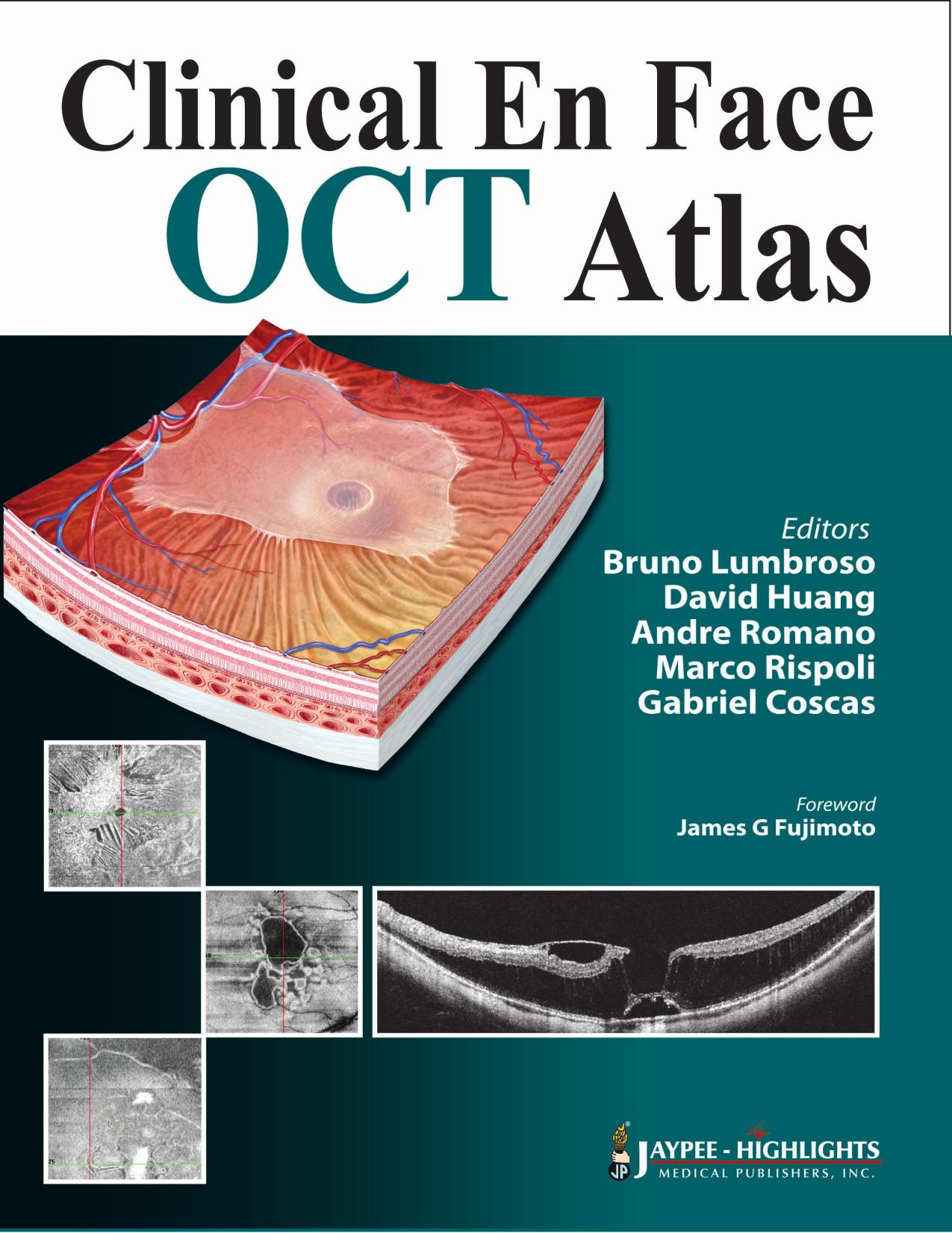 Clinical en Face OCT Atlas by Bruno Lumbroso; David Huang; Andre Romano