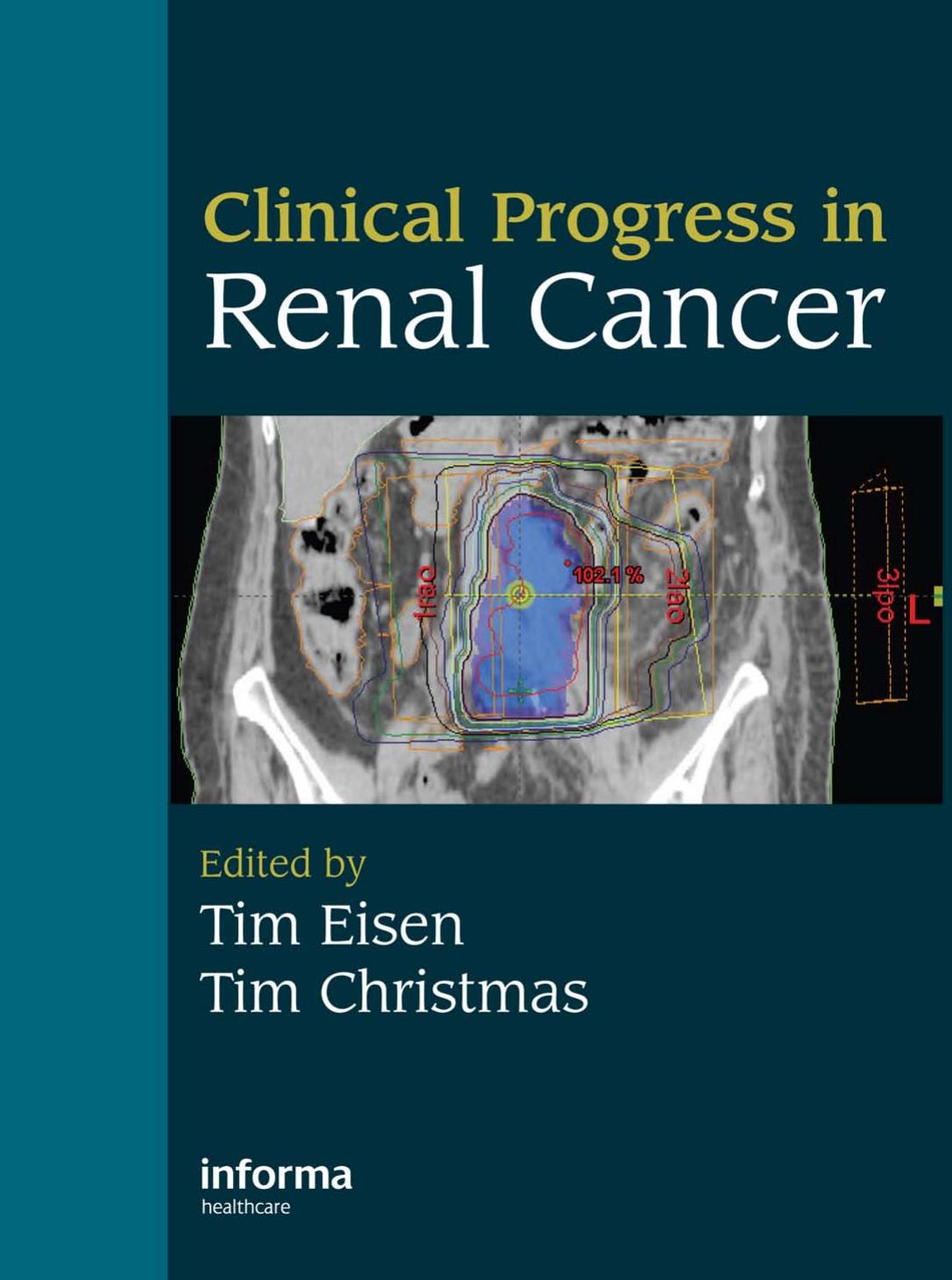 Clinical progress in renal cancer by Eisen Tim; Christmas Timothy J