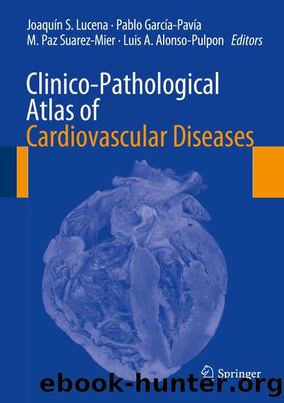 Clinico-Pathological Atlas of Cardiovascular Diseases by Joaquín S. Lucena Pablo García-Pavía M. Paz Suárez-Mier & Luis A. Alonso-Pulpón
