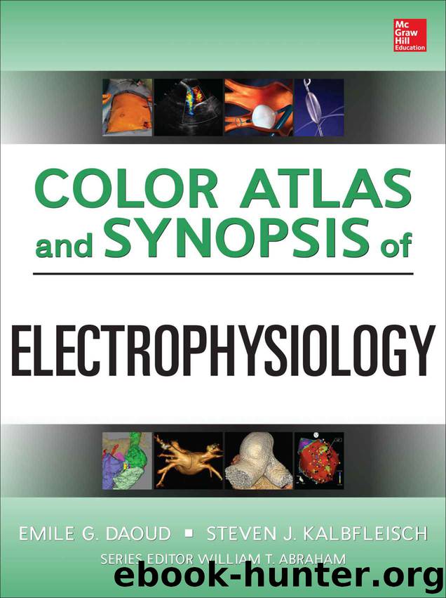 Color Atlas and Synopsis of Electrophysiology by Daoud Emile & Kalbfleisch Steven
