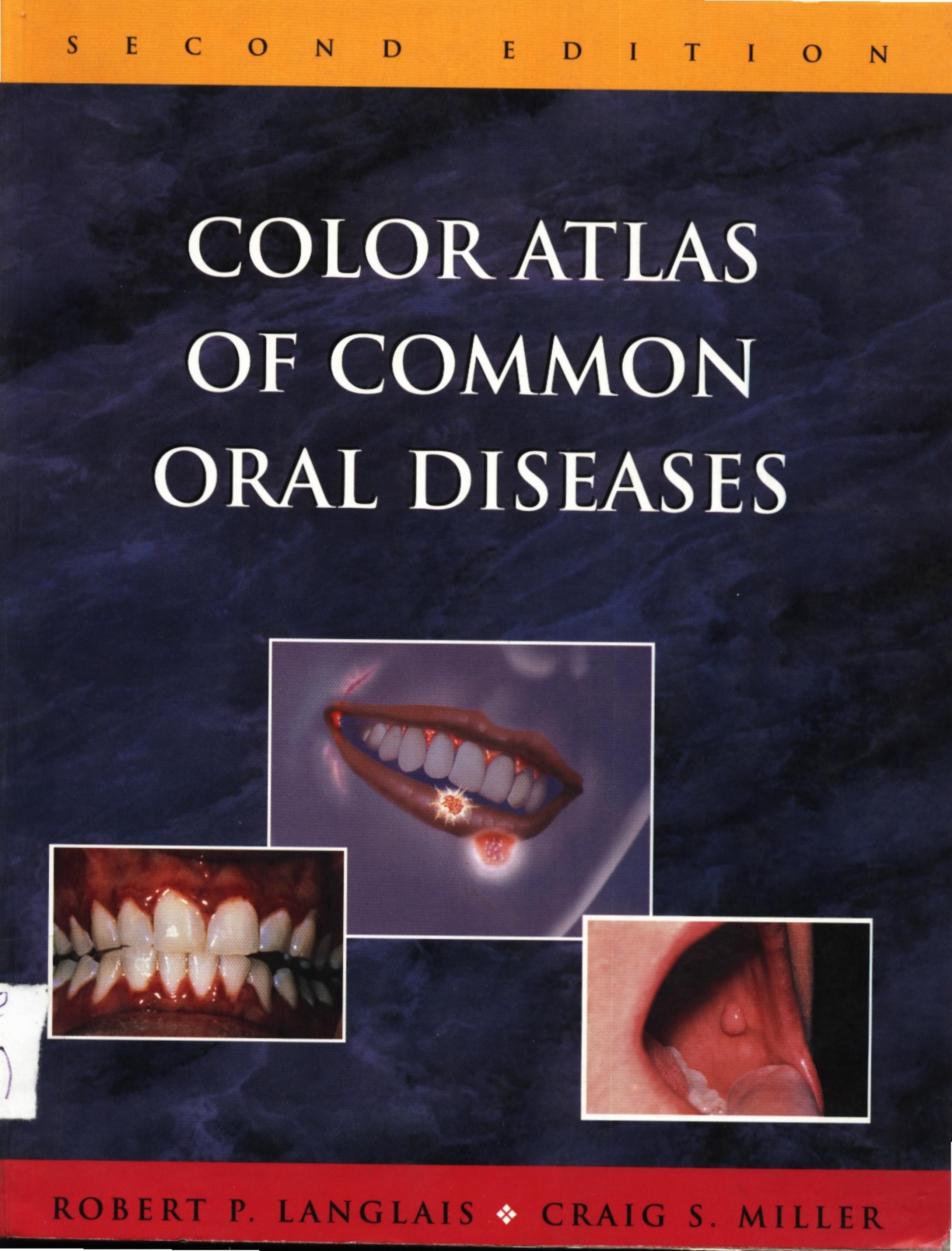 Color Atlas of Common Oral Diseases 2nd ed by R. Langlais C. Miller WW